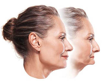 implant overdentures san antonio