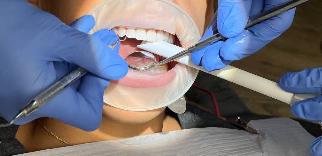 Dental Procedure