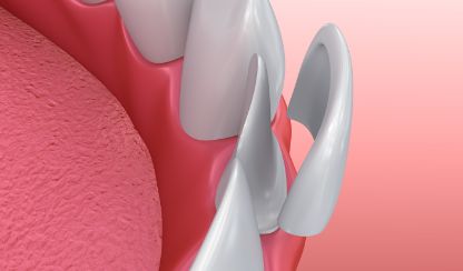 AdobeStock 126371120