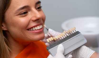 veneers